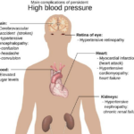 Hypertenze u dětí a dospívajících: Jak rozpoznat a léčit vysoký tlak